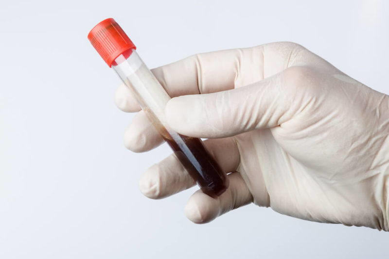 Lab, Blood, and Urine Tests