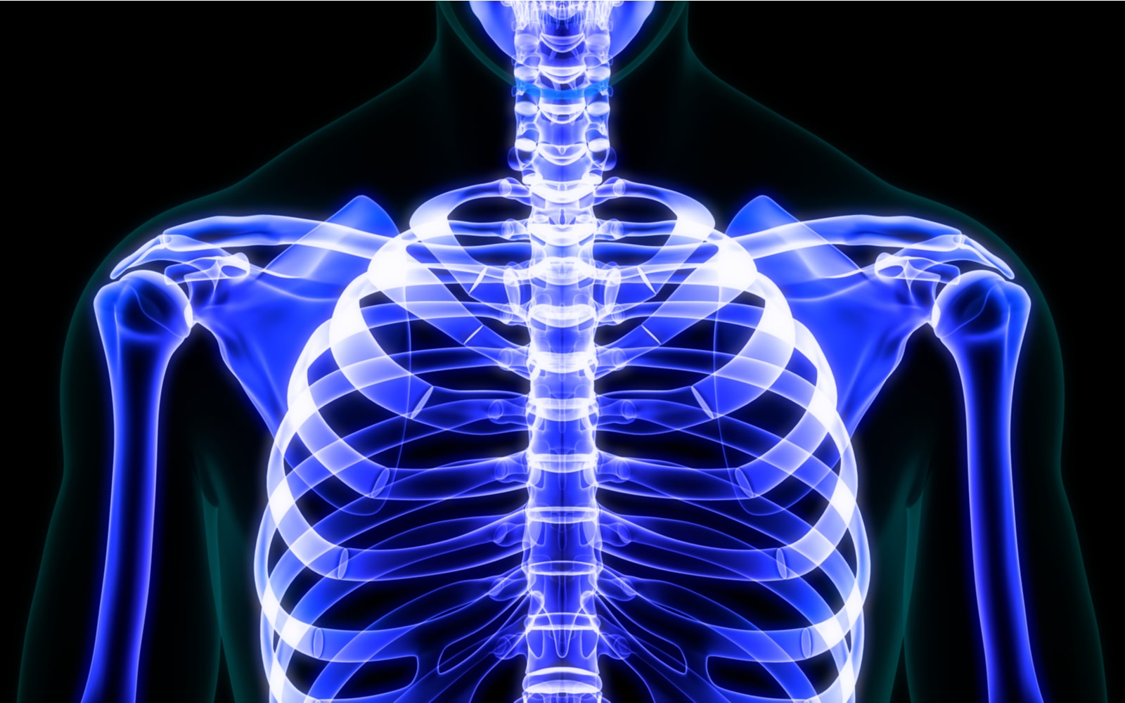 X-Ray Of Chest